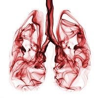 Bacterial Infection May Be True Cause of COPD