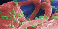 Combination Antiretroviral Therapy Effective for Preventing Spread of HIV Between Cells
