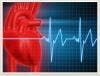 Men with Angina Face Greater Risk of Heart Attack and Death Compared with Women