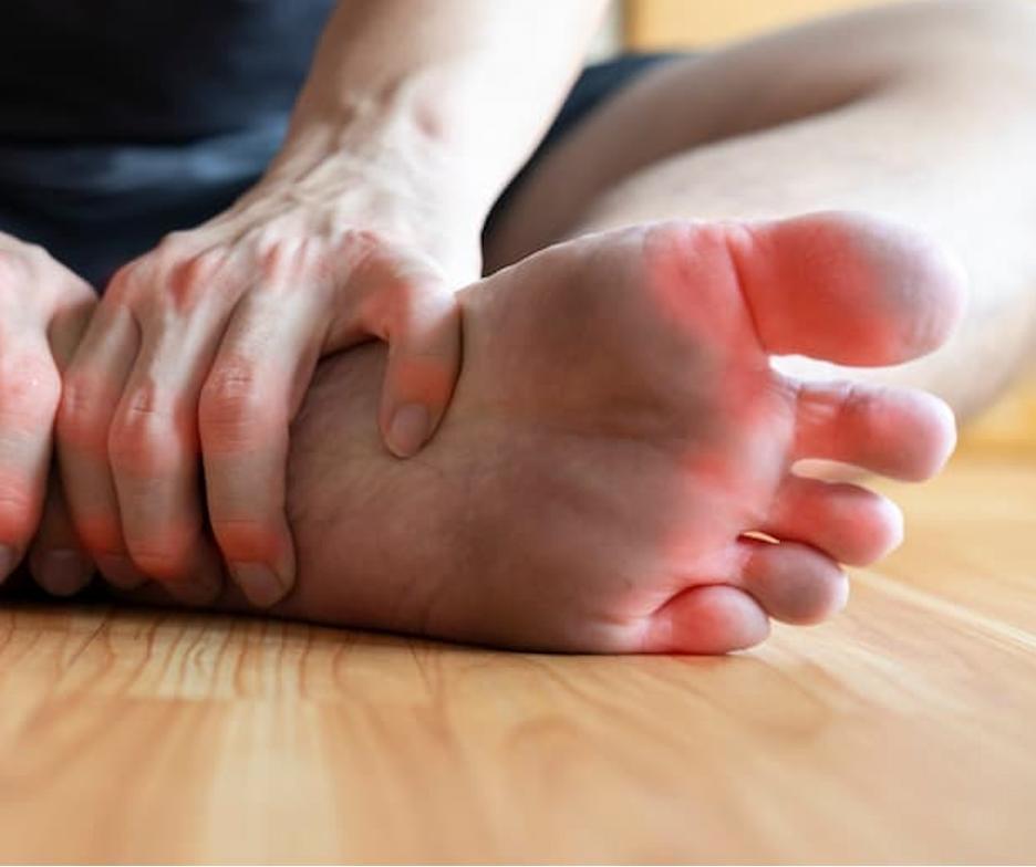 Gout Complications More Common in Patients With Cirrhosis