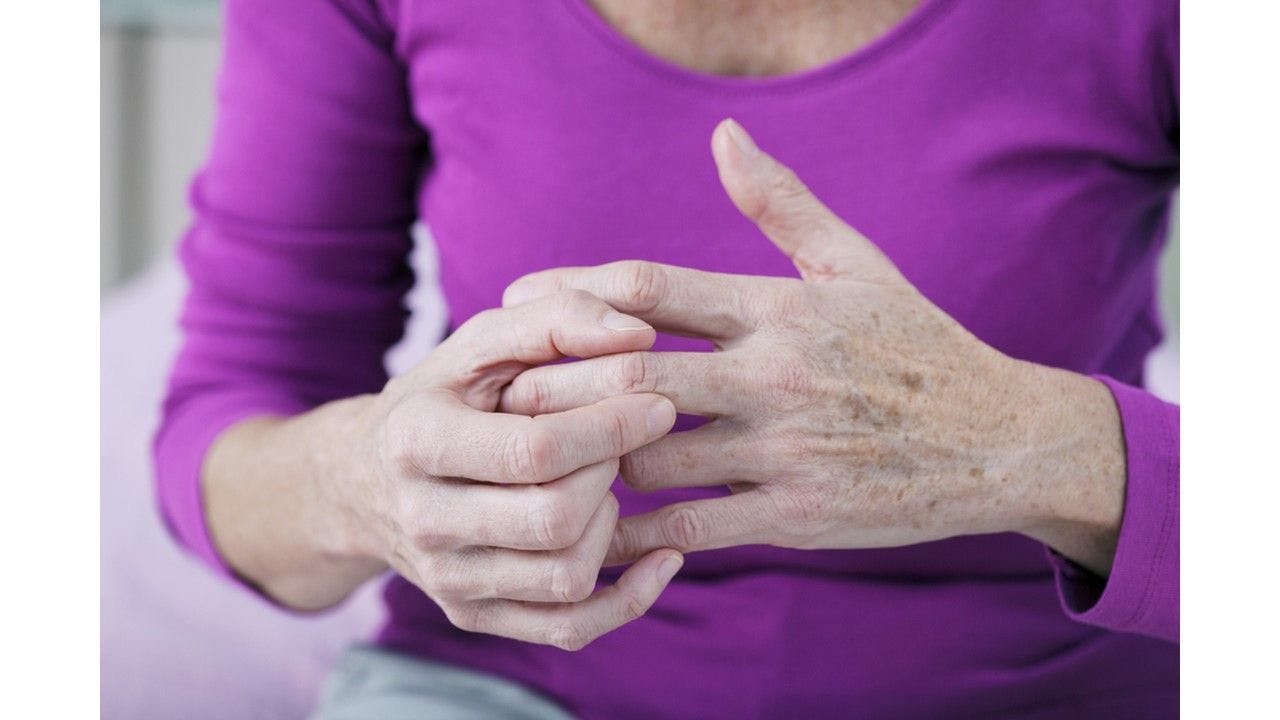 Quiz:  What is the best state to live in if you have rheumatoid arthritis?