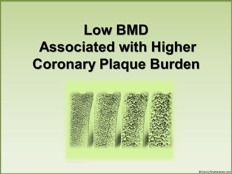 Low BMD Associated with Higher Coronary Plaque Burden