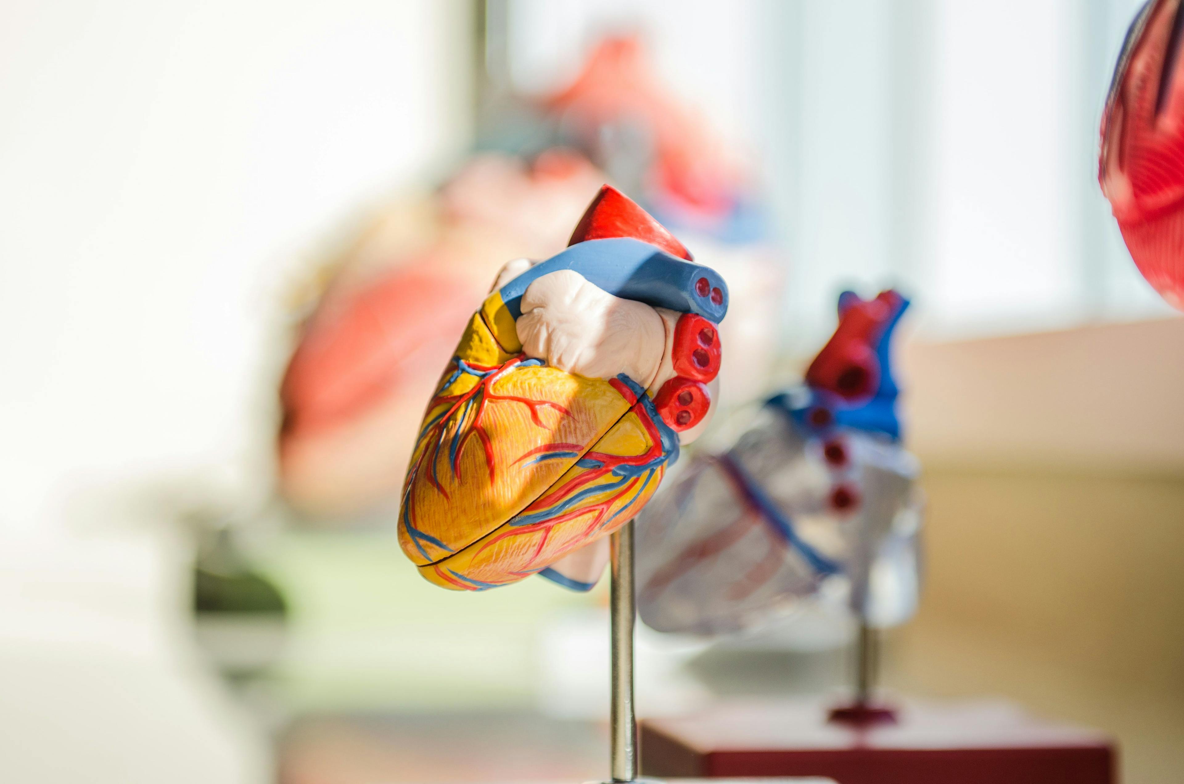 Early Evolocumab Cuts LDL-C in Post-PCI Patients with Acute Myocardial Infarction