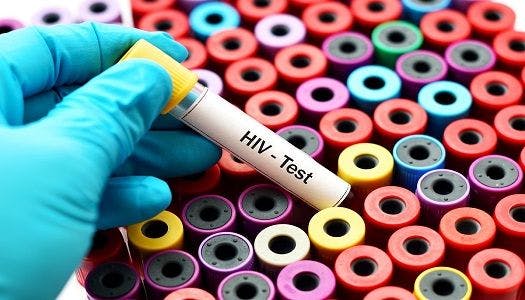 New Therapy Could Mark "Functional Cure" for HIV