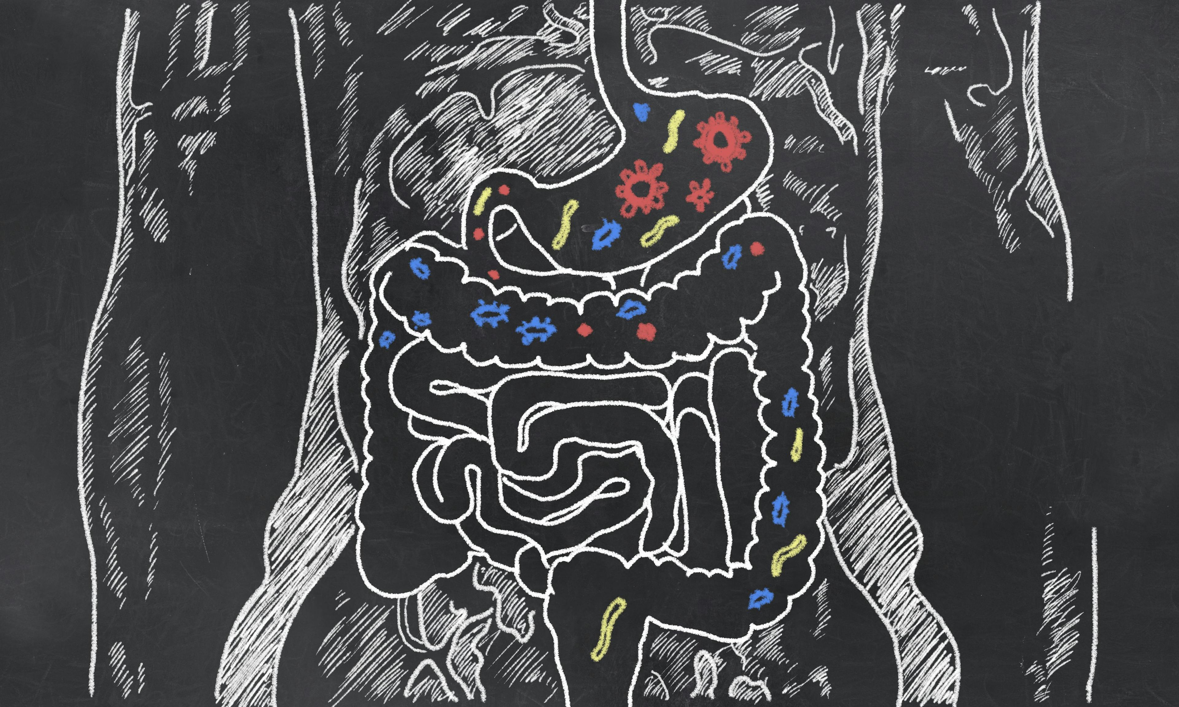 Depletion of gut bacteria identified in ankylosing spondylitis
