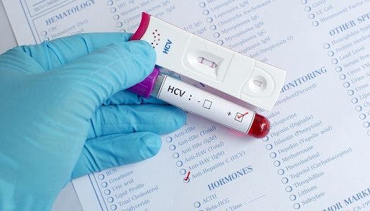 hepatitis c, HCV, at-risk, test, population, patients