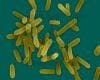 New Targets Now a Possibility for Fighting Pseudomonas aeruginosa Infection