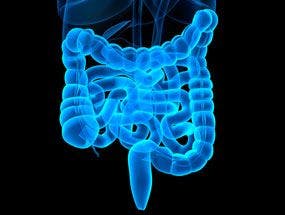 Five Categories of Lower Gastrointestinal Functional Bowel Disorders in Revised Rome IV Criteria