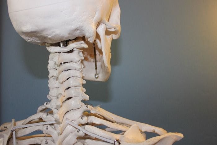 Discovery of New Skeletal Disorder May Shed Light on Another