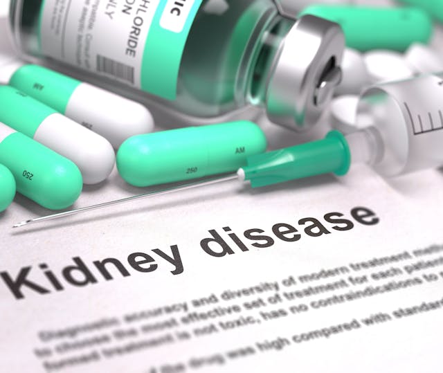 Kidney Disease IgA Nephropathy | Credit: Fotolia