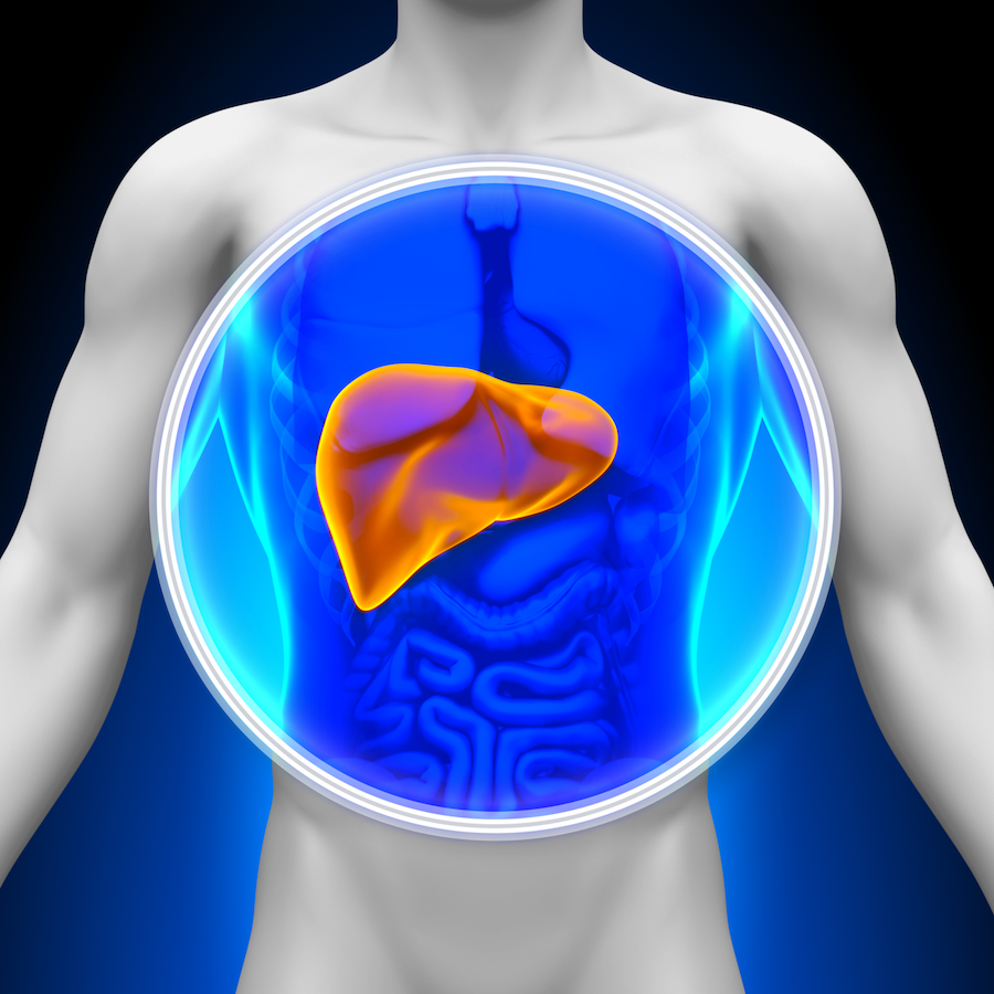 Nonalcoholic Fatty Liver Disease May Be Underappreciated Comorbidity Among People With HIV