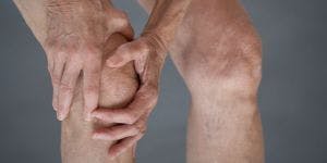 Osteoarthritis Predicts Persistent Knee Pain in Women Over 50