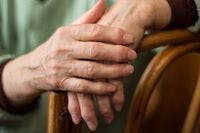 Filgotinib Drives 12-Week Benefit for Rheumatoid Arthritis