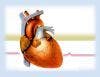 Coronary Artery Bypass Graft Survives Pay-for-Performance