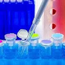PCR Testing Revolutionized Diagnosis, Treatment of Infectious Uveitis