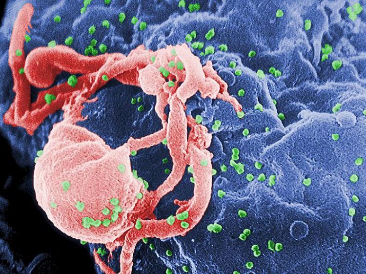 HIV Treatment Tivicay Receives FDA Approval