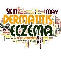 Atopic Dermatitis Linked to Staph Colonization