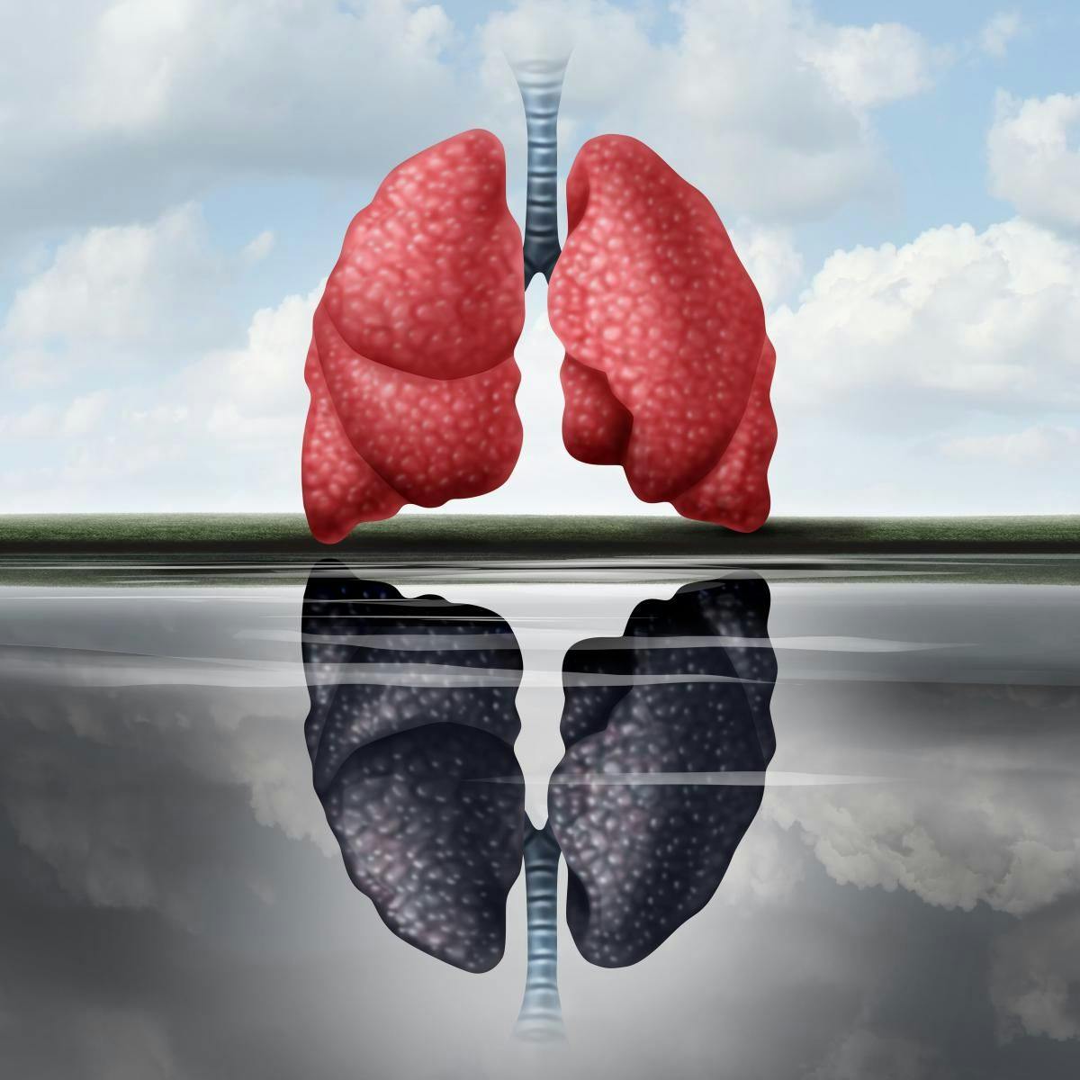 Vertex Initiates Phase 3 of Triple Combination for Cystic Fibrosis