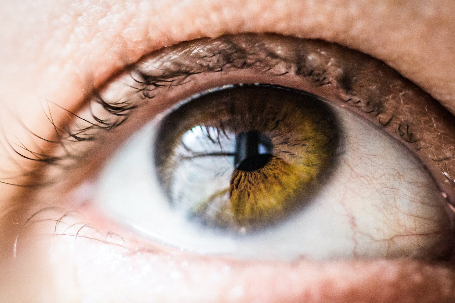 Research Shows Low Dose Atropine Links to Myopia Progression in Children