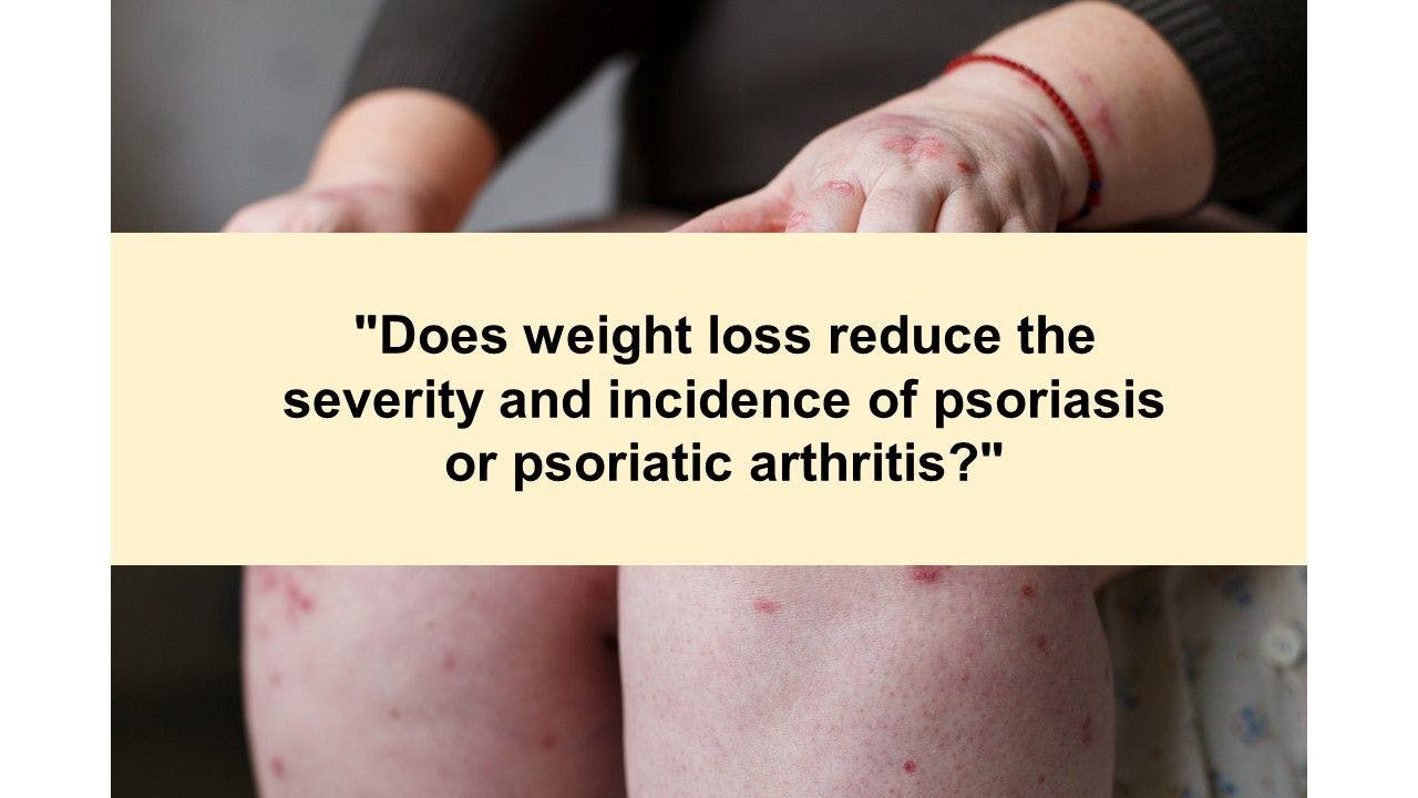 Psoriatic Arthritis Health Quiz: Is it axial PsA or AS?