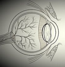 Study: Optic Neuritis Changes Retinal Structure in MS Patients
