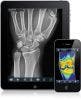 FDA Drafts Regulations for Use of Mobile Medical Apps