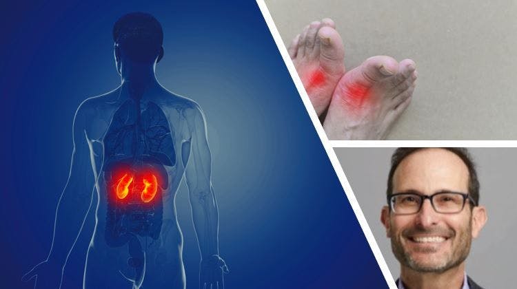 gout as kidney disease