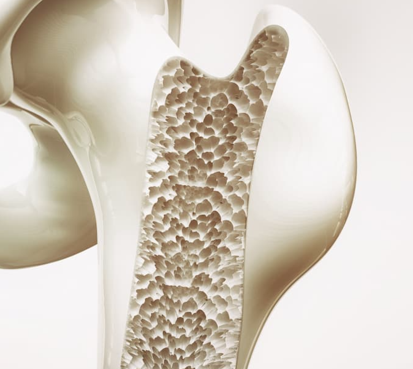 Bone density | Image Credit: Adobe stock/Crevis