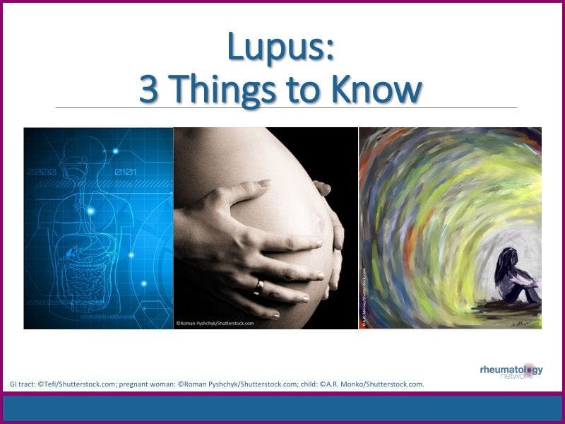 Lupus: 3 Things to Know
