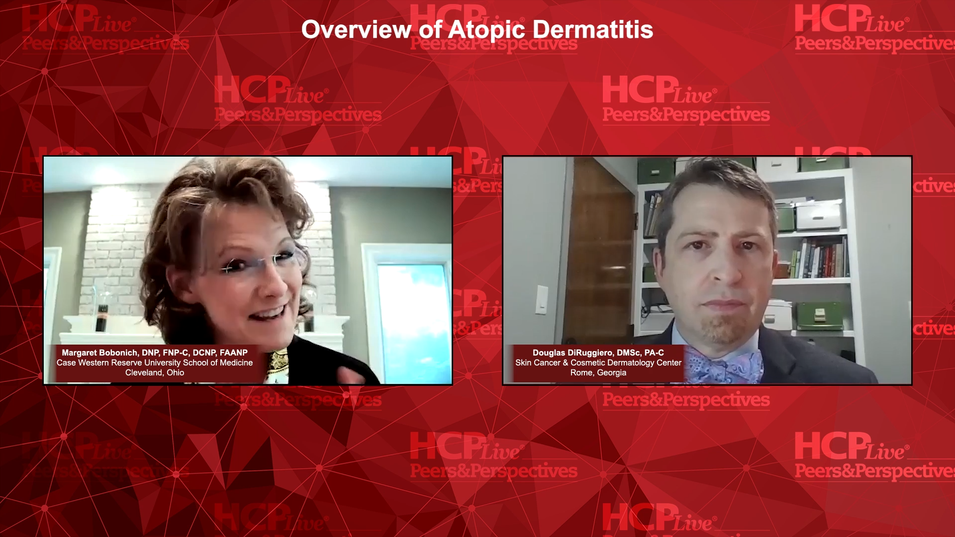 Overview of Atopic Dermatitis