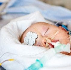 FDA: Surgery on Babies Risks Brain Damage