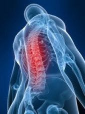 Reducing Mortality During Spinal Infusion Of Opioids