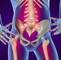 Anti-TNF Treatments for Ankylosing Spondylitis Decrease Need for Hip Replacement