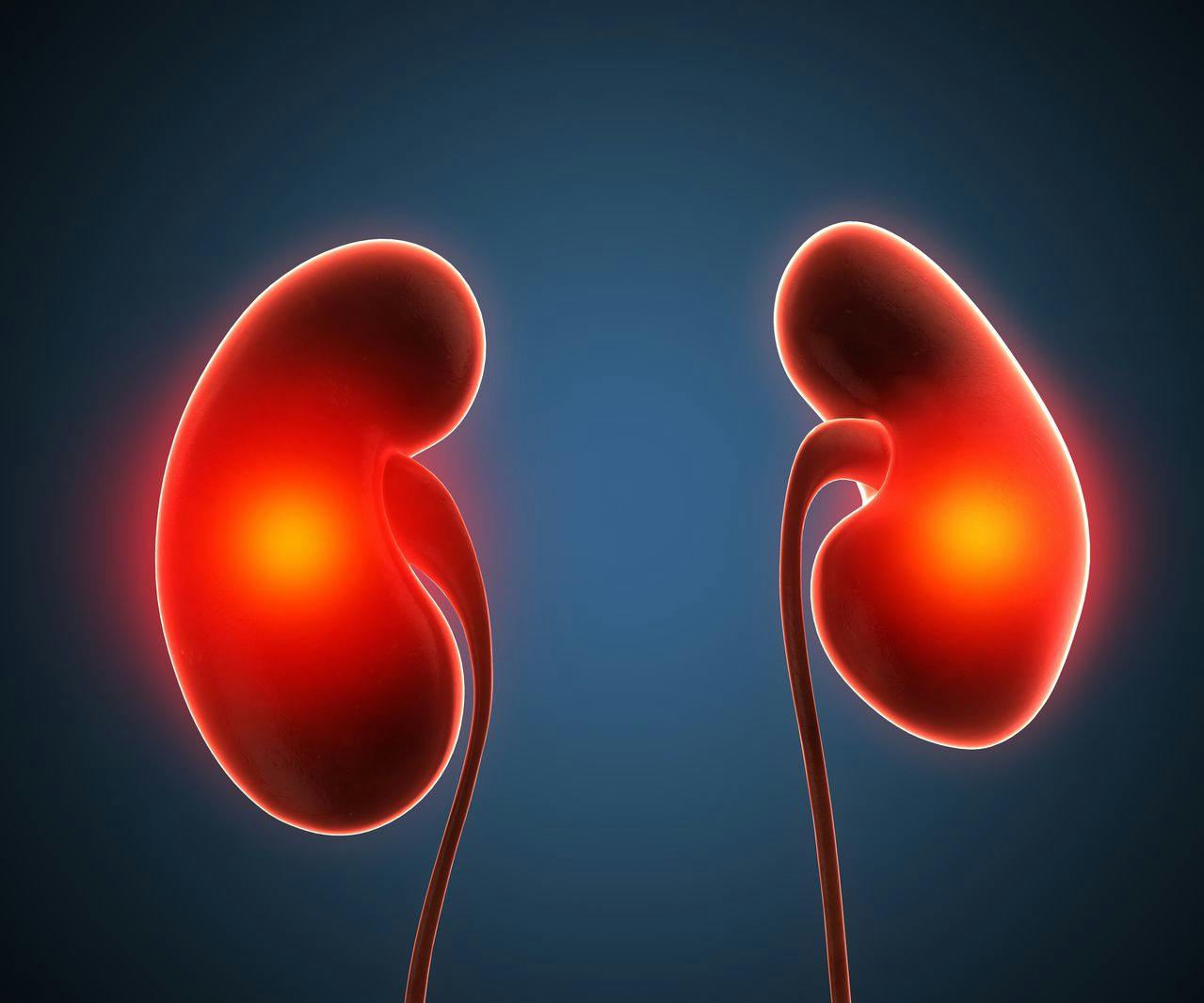 Phase 2 Bardoxolone Trial Shows Efficacy for Alport Syndrome- & ADPKD-Caused CKD