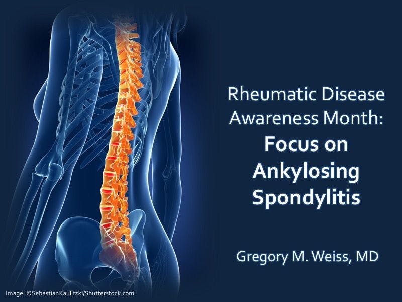 Rheumatic Disease Awareness Month: Focus on Spinal Mobility in Ankylosing Spondylitis