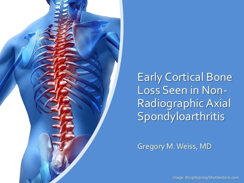 Early Cortical Bone Loss Seen in Non-Radiographic Axial Spondyloarthritis