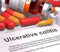 Infliximab Discontinuation Leads to Ulcerative Colitis Relapse
