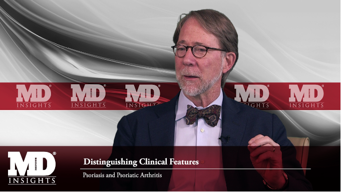 Spondyloarthritis: Challenges in Diagnosis