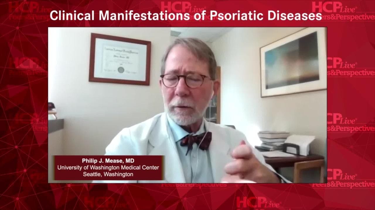 Clinical Manifestations of Psoriatic Diseases 