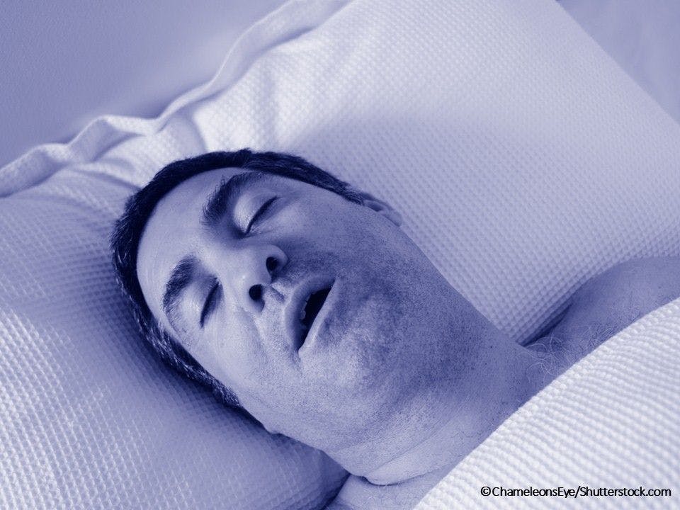 man snoring obstructive sleep apnea gout