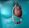 Women Get Short Shrift in Many Heart Device Studies