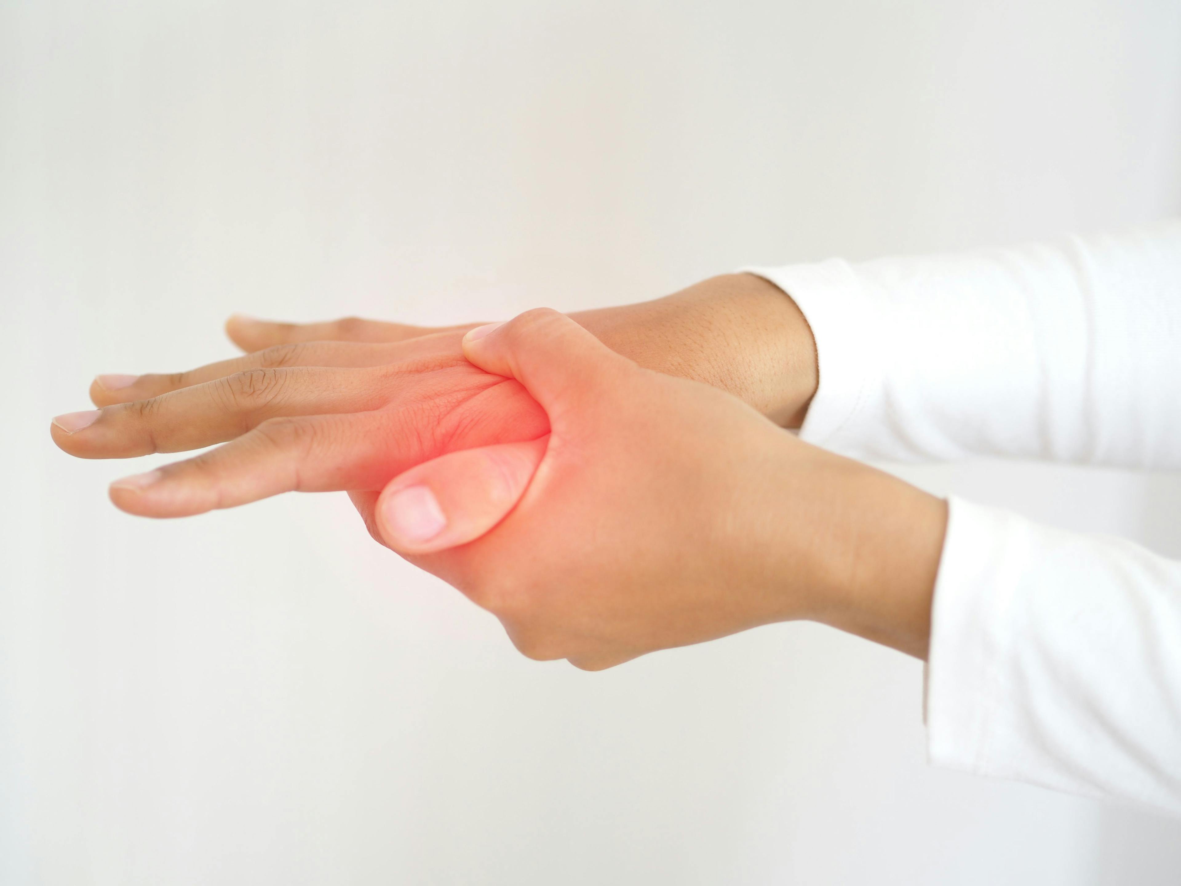 Swollen Joint Count Questioned in Moderate, Oligoarticular Psoriatic Arthritis 