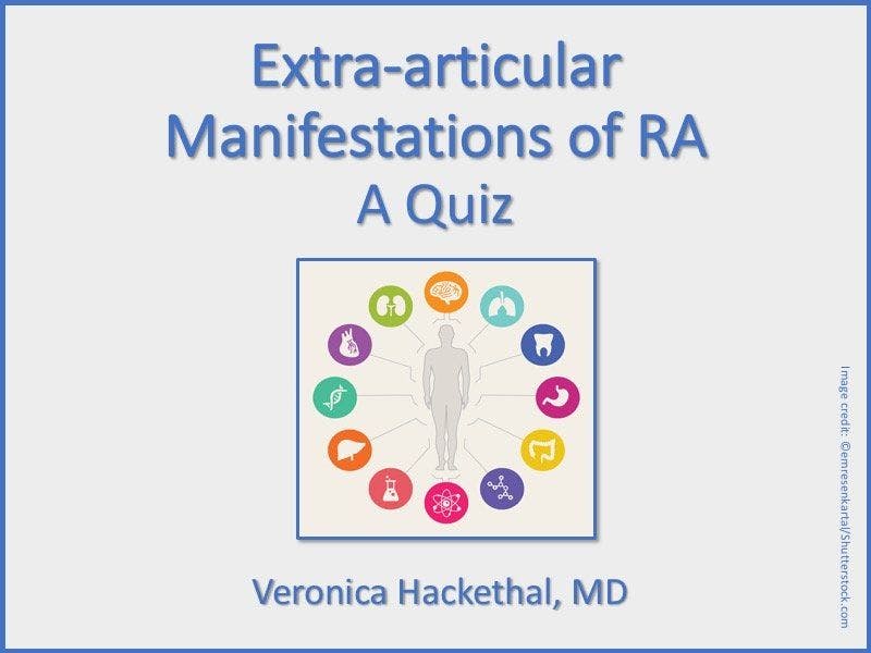 Extra-articular Manifestations of RA: A Quiz