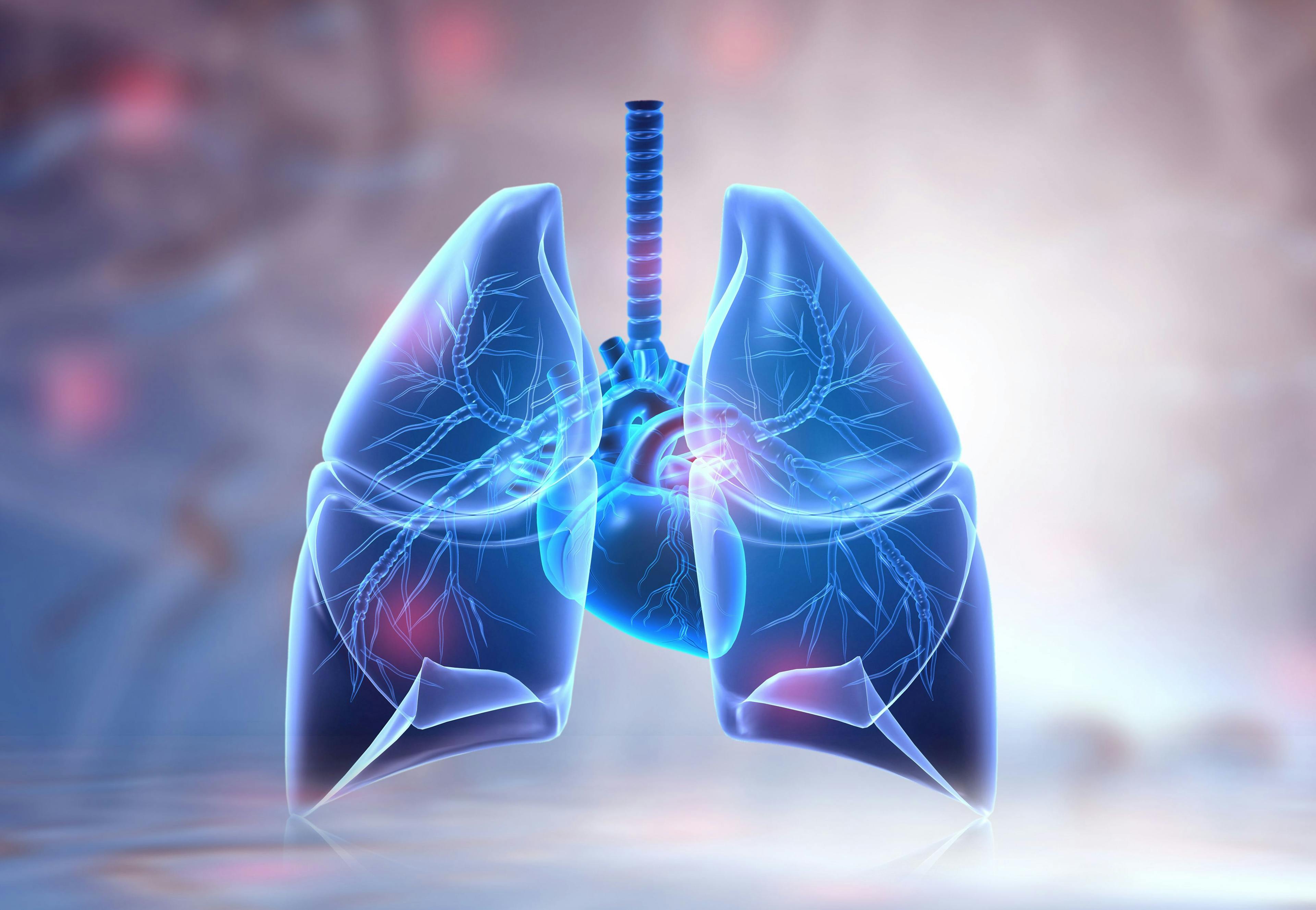 Interstitial Lung Disease Increases Mortality Risk in RA