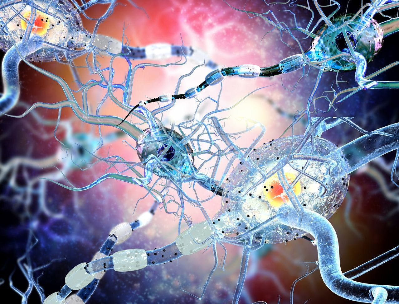 Fingolimod Linked with Lower Relapse Rate in Pediatric Patients with Multiple Sclerosis