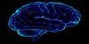 Deep Brain Stimulation Treatment for Tardive Dyskinesia Successful in 1 Adolescent Patient