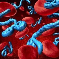 Promising Results on Ebola Antiviral