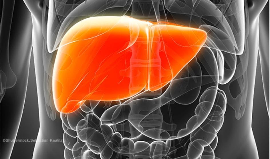 The Skinny on Reducing Liver Fat with Empagliflozin in Type 2 Diabetes