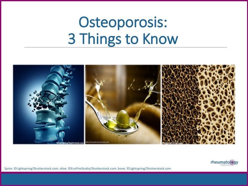 Osteoporosis: 3 Things to Know