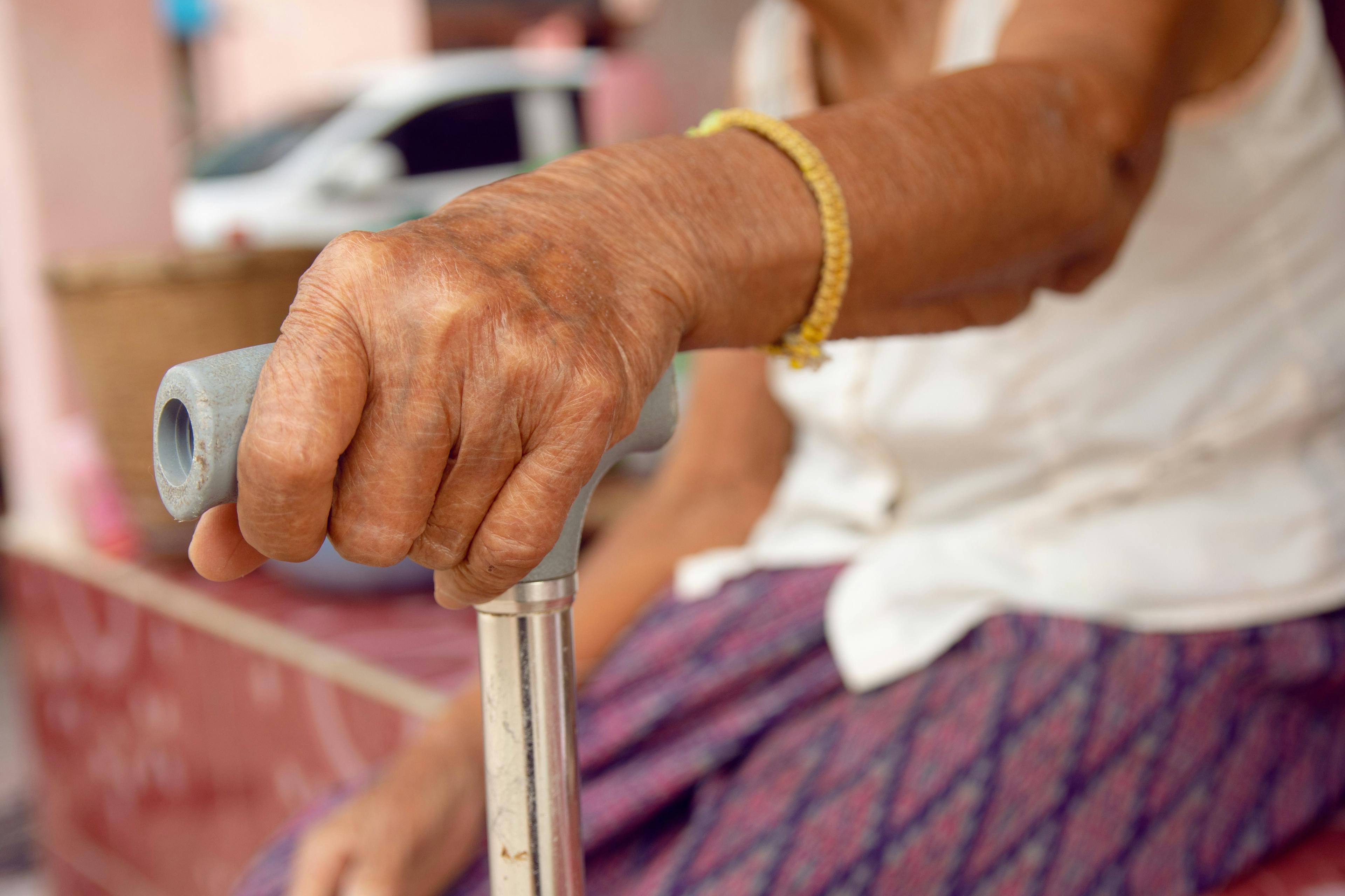 Long-term remission in rheumatoid arthritis is rare